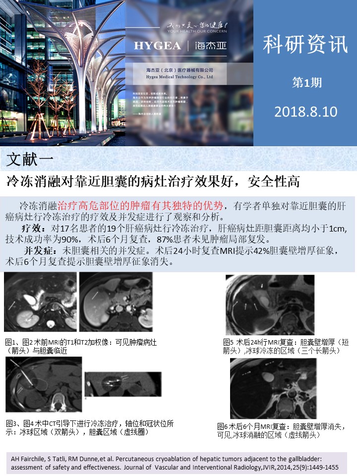 【9001cc金沙以诚为本科研资讯】第1期——肝、肺癌消融